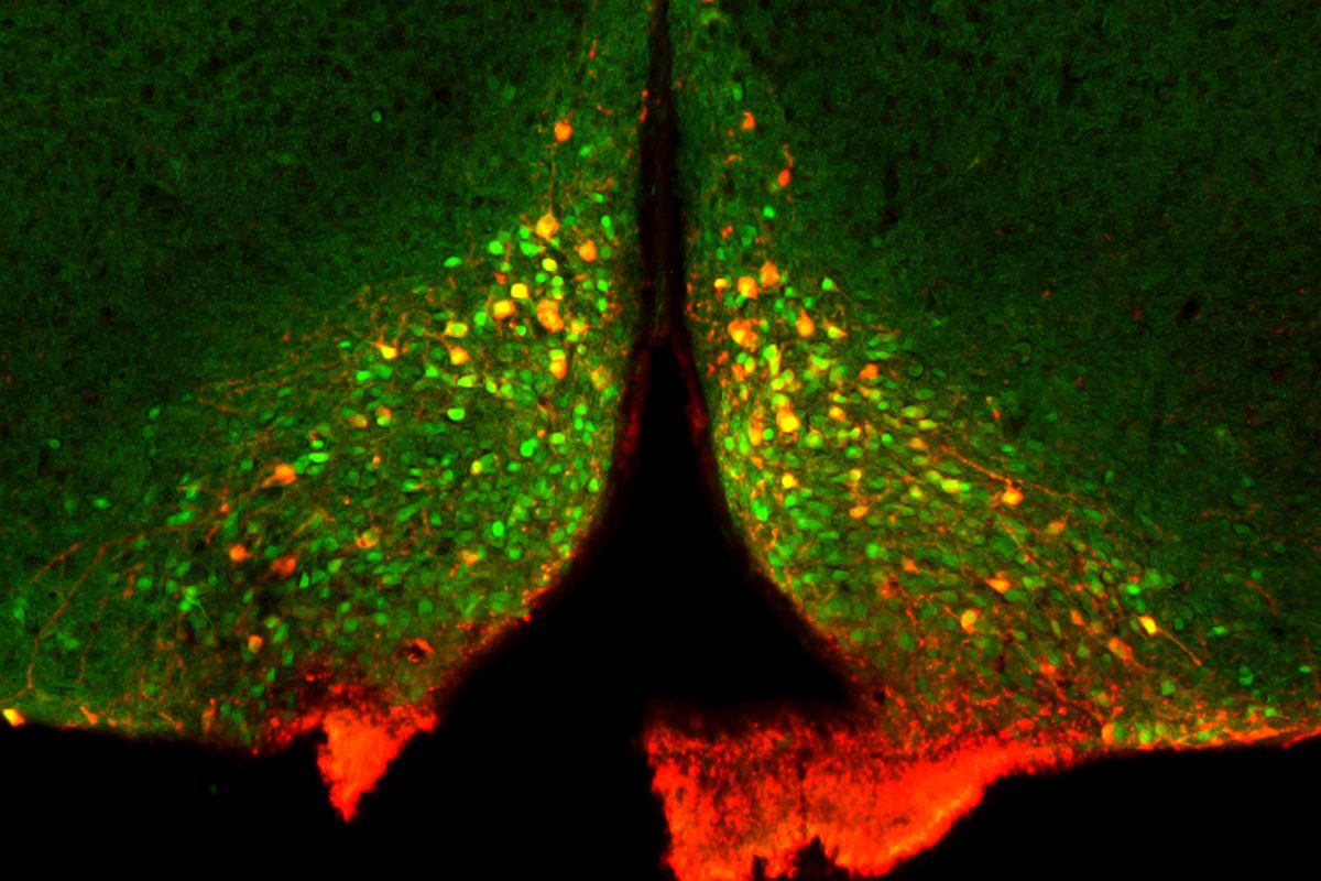 Dopamine neurons in the zona incerta. (Photo Courtesy of Zhang Laboratory)